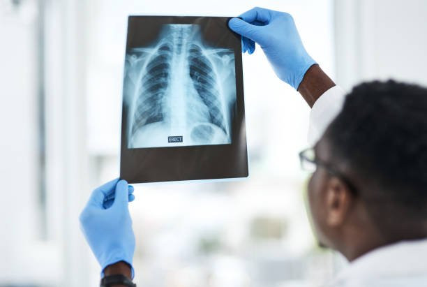 Black doctor examining a chest x-ray.